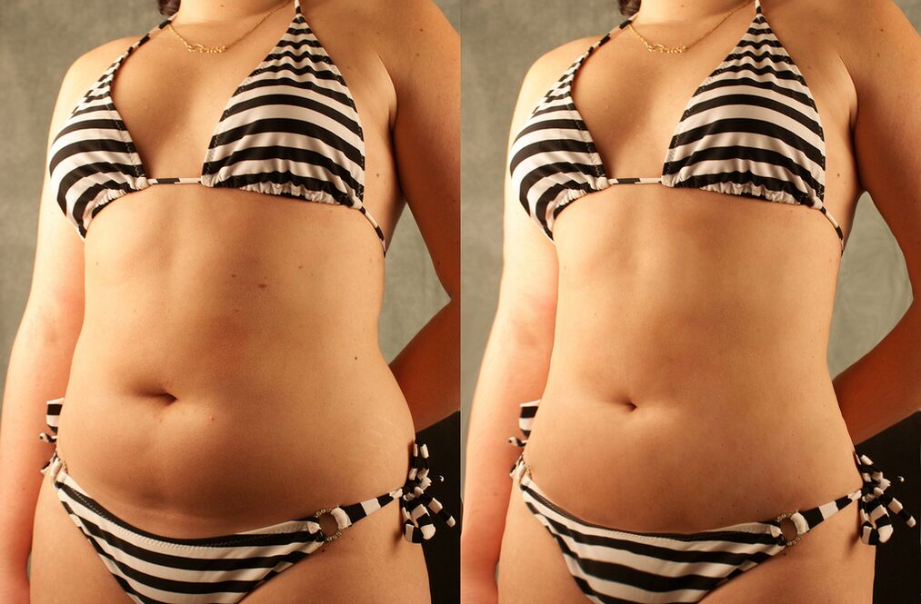 comparaison